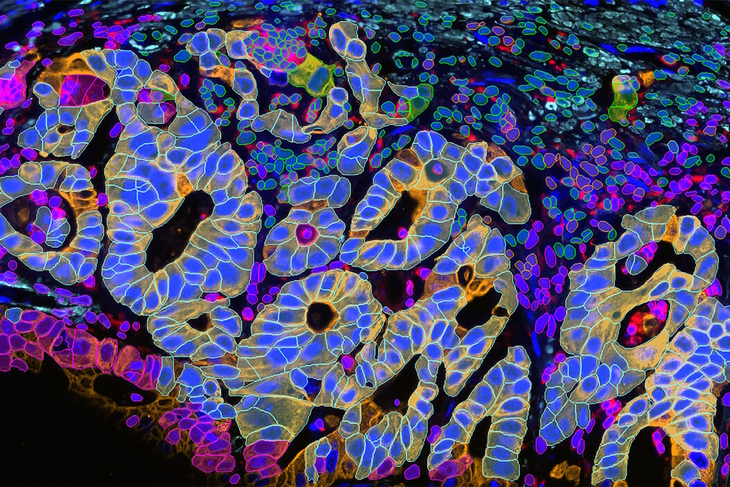 2D slice of colon cancer tissue stained with 30 markers and imaged using the Cell DIVE system. Analysis performed using Aivia 13’s new multiplex cell detection recipe and automatic clustering tool. Each phenotype denoted in a different color. 2D_slice_of_colon_cancer_tissue_stained_with_30_markers_Aivia_Cell_DIVE.jpg