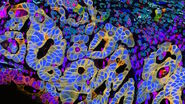 2D slice of colon cancer tissue stained with 30 markers and imaged using the Cell DIVE system. Analysis performed using Aivia 13’s new multiplex cell detection recipe and automatic clustering tool. Each phenotype denoted in a different color.