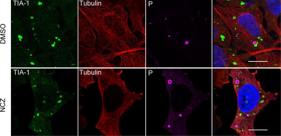 Figure 1: Effect of nocodazole (NCZ) on rabies-virus-induced stress granules (SGs). 