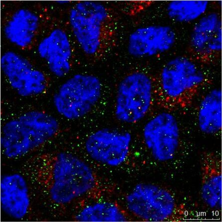 The Immuncytochemistry (ICC) image shows staining of two proteins in cells of the same type (MDCK) by indirect Immunofluorescence (IF)