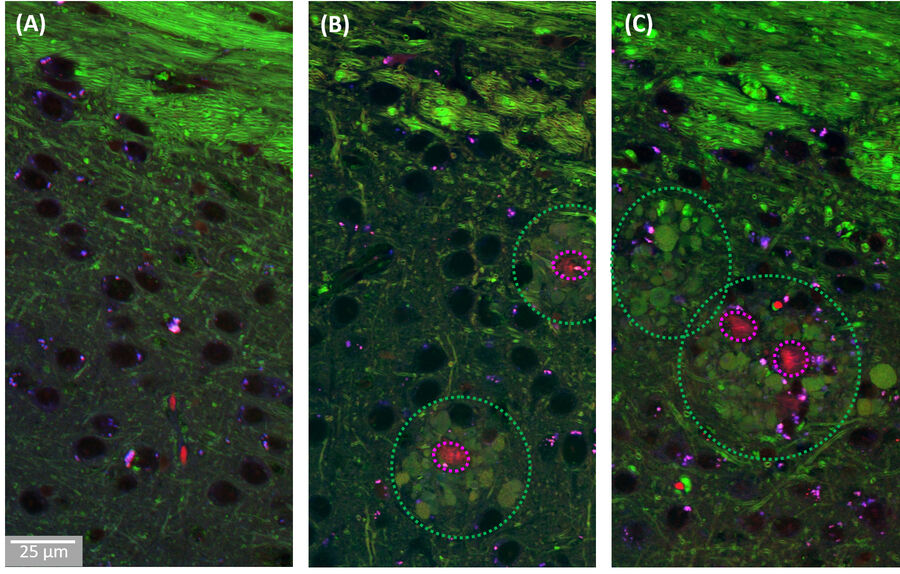 High-resolution images of healthy (A) and diseased (B, C) brain slices.