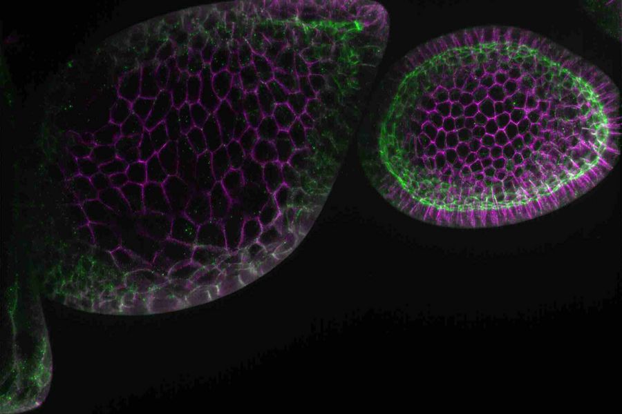 THUNDER image representing a 3D maximum intensity projection of a 27.5 μm thick z-stack of Drosophila follicles. The THUNDER image was processed with LVCC. Green indicates aPKC and magenta Dlg. Images courtesy of Mark Khoury and Dr. David Bilder, University of California, Berkeley, USA.