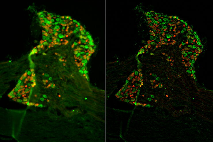 Raw widefield and THUNDER image of a mouse dorsal root ganglion with tdTomato (red) expressed in the sensory neurons.