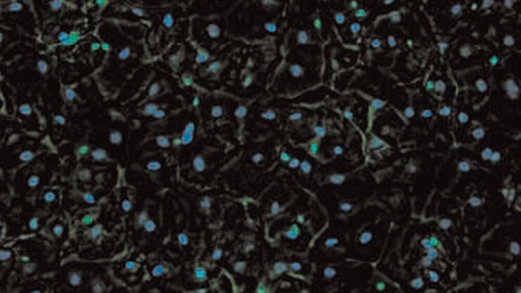 SPERM HY-LITER™ staining of a sexual assault smear slide performed by forensic DNA crime laboratory.