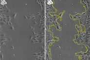 Images of smooth muscle cells during wound healing. Courtesy L.S. Shankman, Ph.D., University of Virginia.