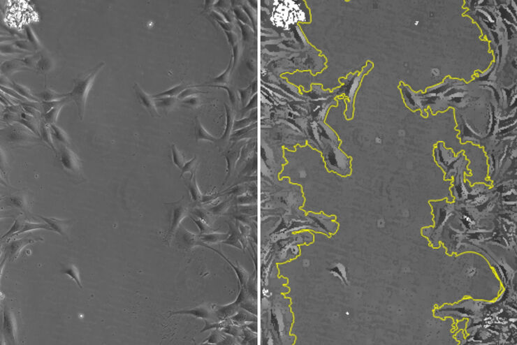 Images of smooth muscle cells during wound healing. Courtesy L.S. Shankman, Ph.D., University of Virginia. Images of smooth muscle cells during wound healing. Courtesy L.S. Shankman, Ph.D., University of Virginia.