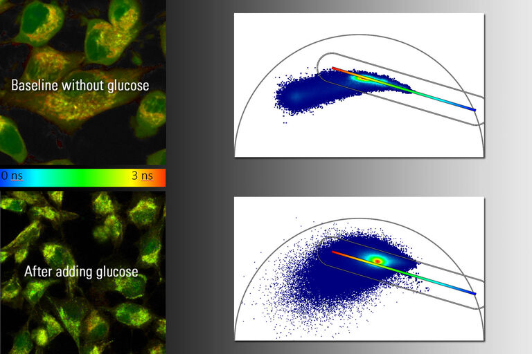 NADH-Autofluroeszenz kultivierter HeLa-Zellen vor und nach der Glukosebehandlung. Links: Qualitatives Ergebnis mit TauContrast. Rechts: Quantitative Analyse mit dem Phasorplot in FALCON.