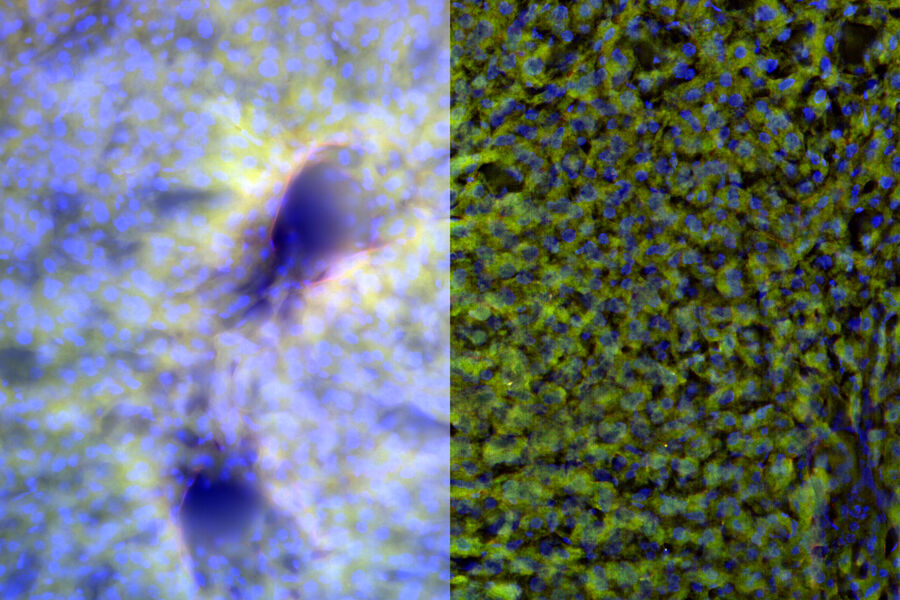 Liver Section - THUNDER Imager 3D Tissue