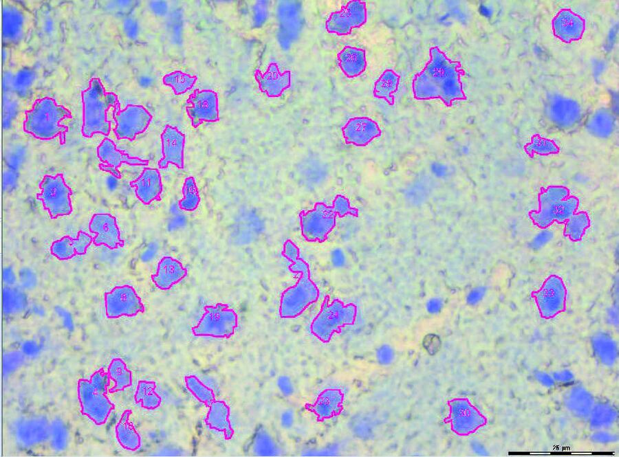 Brain section 12 μm, before dissection, objective 63x, stained with Toluidin blue. Detection of shapes by AVC+. The selected shapes are within the chosen detection criterias.