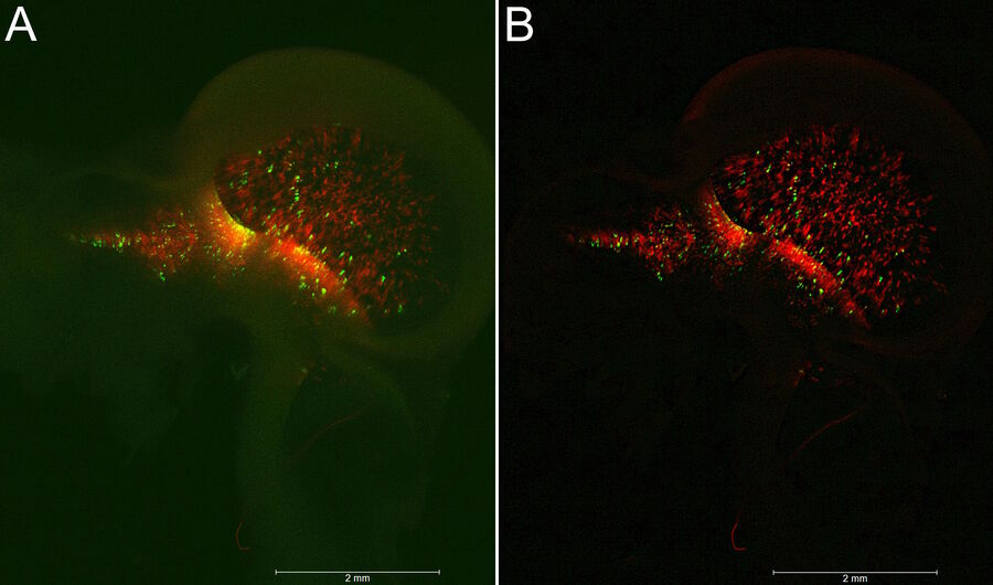 Fig. 1: Image of a chick embryo brain with mScarlet RFP and sonic-hedgehog-regulated EGFP indicating neuronal progenitors: A) Raw widefield EDoF data before computational clearing and B) after SVCC. Image courtesy of Timothy Sanders, MD, PhD, Grossman Institute for Neuroscience, Quantitative Biology, and Human Behavior, University of Chicago, USA.