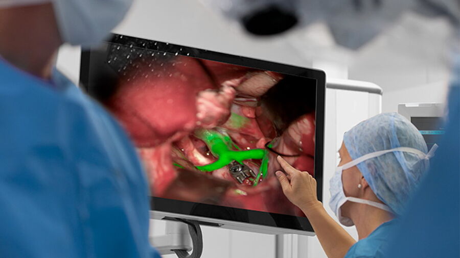 GLOW800 visualization supports every step of neurovascular surgery