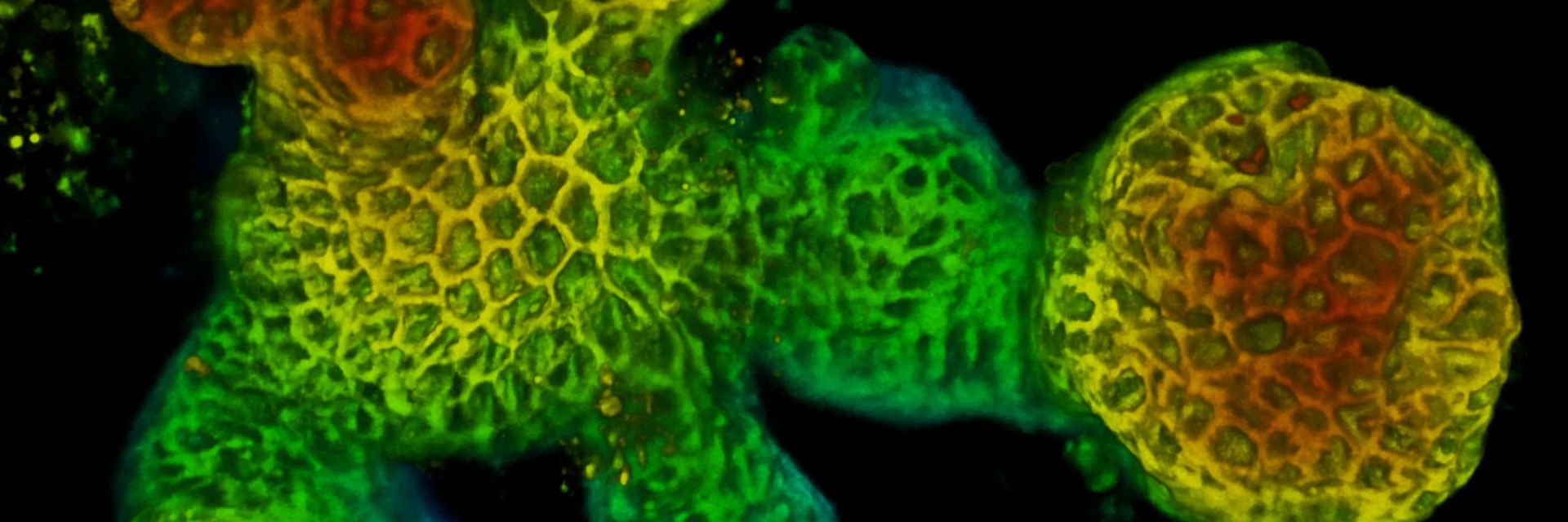 Snapshot of a live mouse intestinal organoid from an 18‑hour timelapse experiment. The fluorescent signal shows cell membranes. Sample courtesy of Sandra Scharaw. Scale bar, 50 µm.