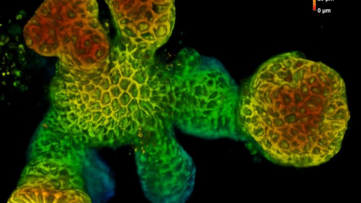 Snapshot of a live mouse intestinal organoid from an 18‑hour timelapse experiment. The fluorescent signal shows cell membranes. Sample courtesy of Sandra Scharaw. Scale bar, 50 µm.