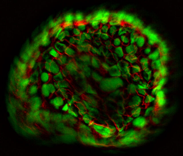 Stack en Z del organoide con THUNDER Imager Model Organism