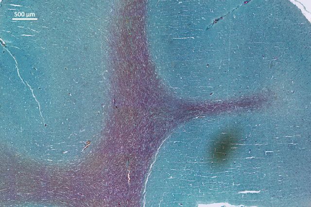 Mosaic of H&E stained tissue using LAS X Navigator
Mosaic of H&E stained tissue using LAS X Navigator