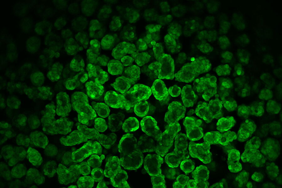 Overview of 14-day-old cysts 