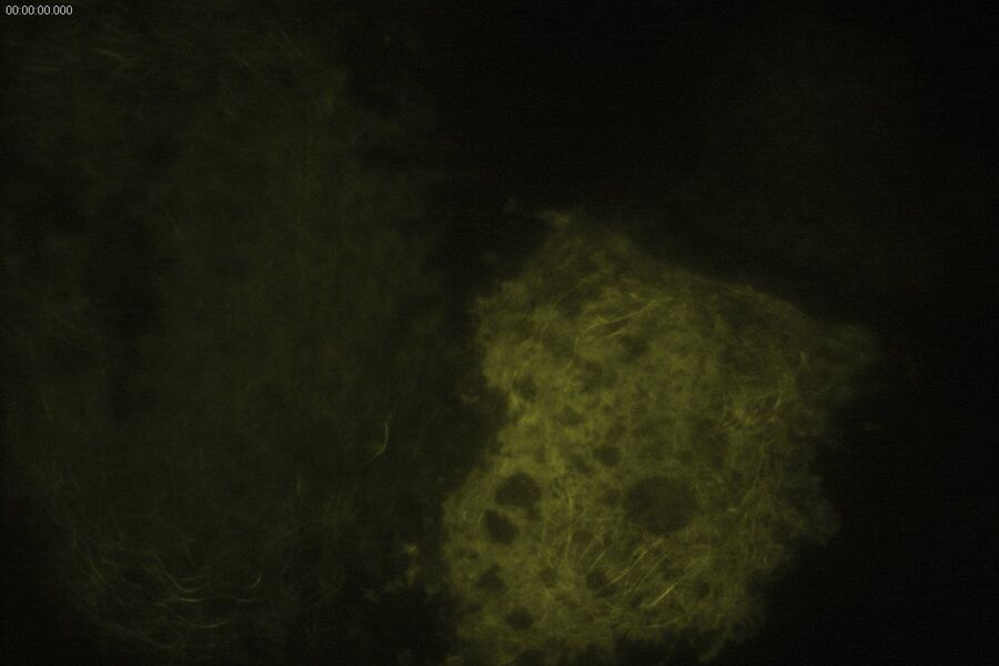 TIRF Image of Tubulin, YFP, penetration depth: 70 mm