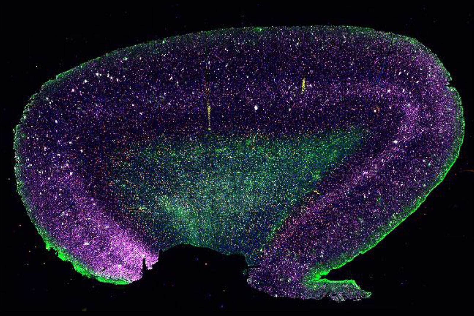 The Shape of the Brain: Spatial Biology of Alzheimer’s Disease | Learn ...