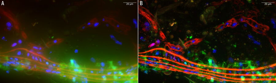 Raw widefield and THUNDER image of the four  visualization targets in a mouse aorta