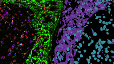 Microscopes and Imaging Systems | Leica Microsystems