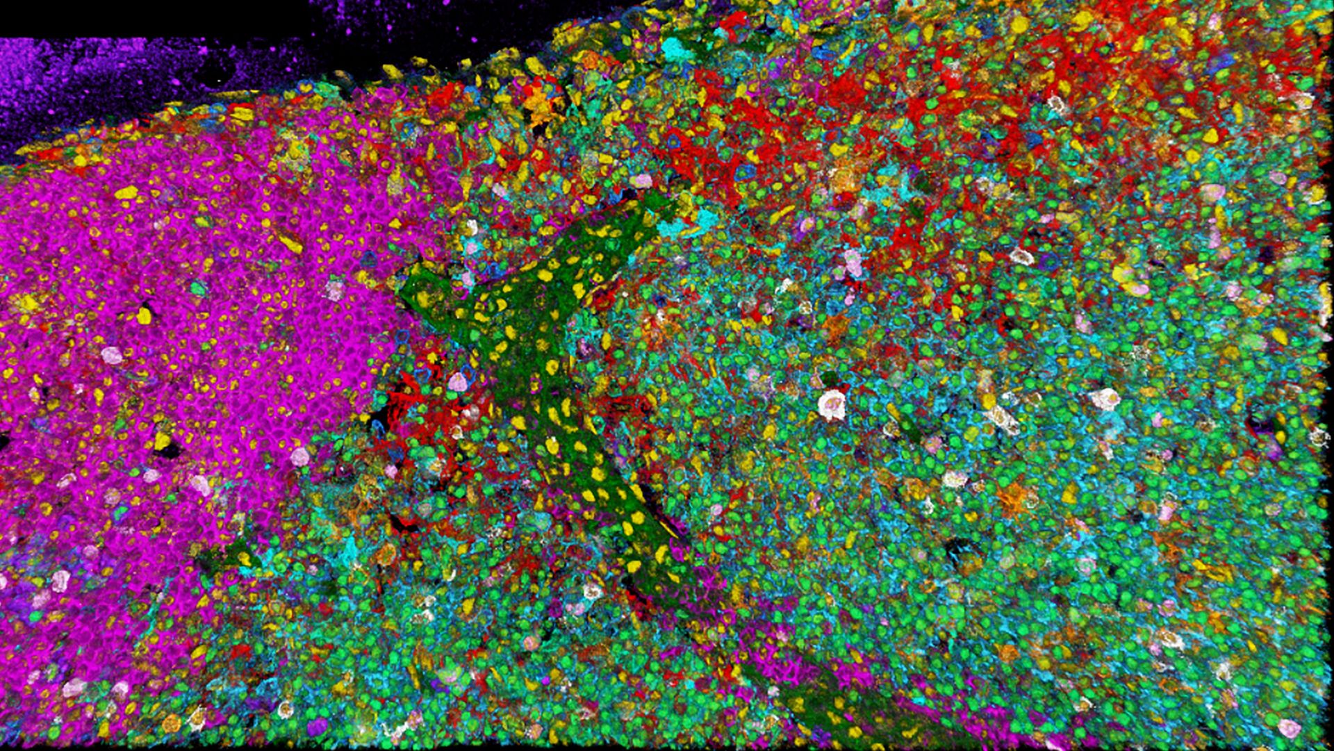 Cell phenotype distribution with 3D 15-plex imaging in murine lymph node. Source: Roberti J., Hecht F., Gai E., Straka T., Holzmeister S., Steinmetz I., Wong H., Alvarez L. Nat. Methods (2024).