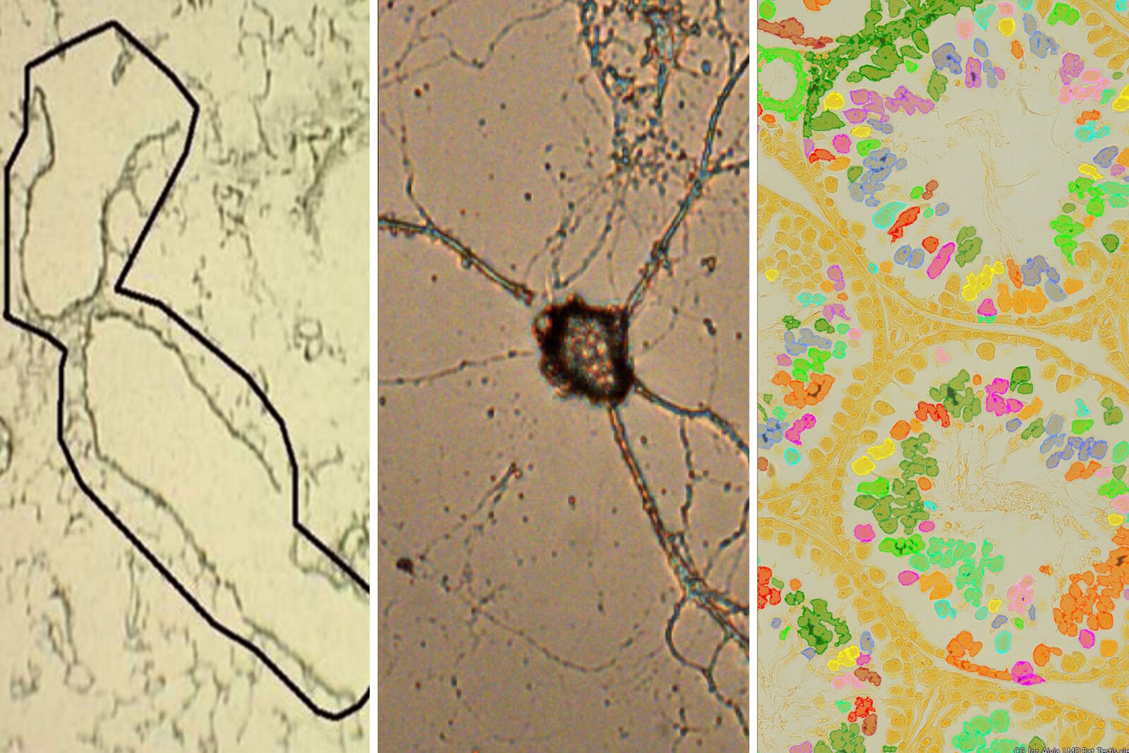 Laser Microdissection Protocols for Tissue and Cell Isolation ...