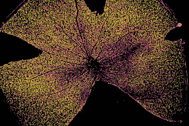 Mouse whole-mount retina. Image courtesy of the Experimental Ophthalmology Group, University of Murcia, Spain.