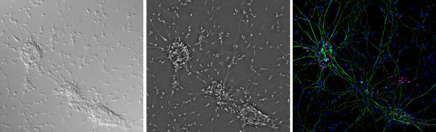 Left) neuronal cell culture in DIC; Middle) phase contrast; and Right) fluorescence microscopy.