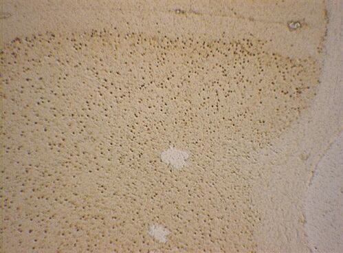 Murine brain cryosection before laser microdissection. DAB staining Murine brain cryosection before laser microdissection. DAB staining
