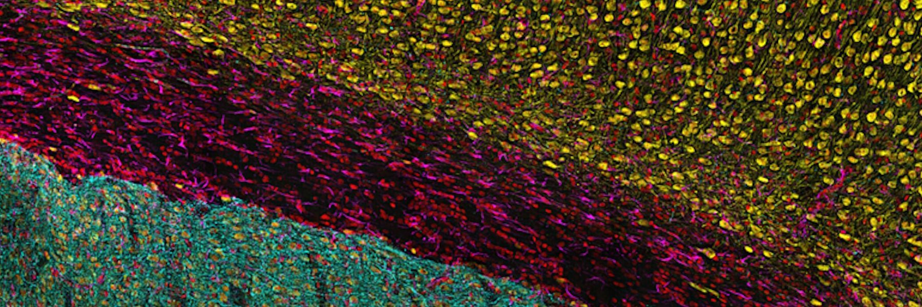 Leica Microsystems Showcases THUNDER Imager Cell Spinning Disk at Imperial College London