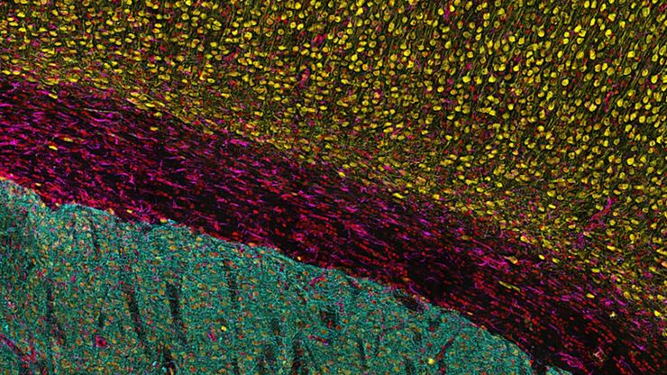 Leica Microsystems Showcases THUNDER Imager Cell Spinning Disk at Imperial College London