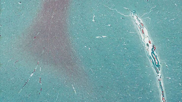 Mosaic scan of a Masson-Goldner stained cat brain. Magnification: 20x. Mosaic scan of a Masson-Goldner stained cat brain. Magnification: 20x.