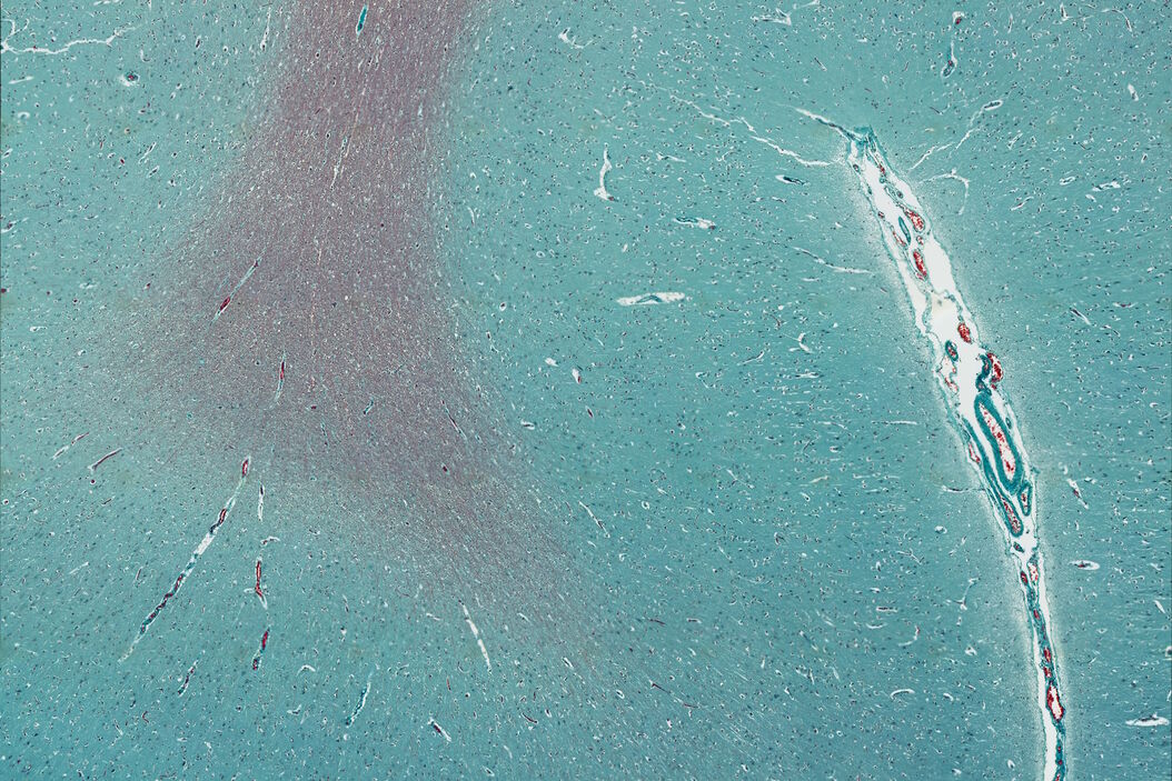 Mosaic scan of a Masson-Goldner stained cat brain. Magnification: 20x. Cat_Brain_Masson-Goldner_20x_Mosaic.jpg