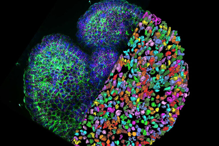 Intestine organoid with smFISH labeling. DNA labeling (DAPI, blue), plasma membrane labeling (green) and smFISH probe (magenta). Image courtesy Prof. Dr. Andreas Moor, Systems Physiology laboratory at the Department of Biosystems Science and Engineering at ETH Zurich.