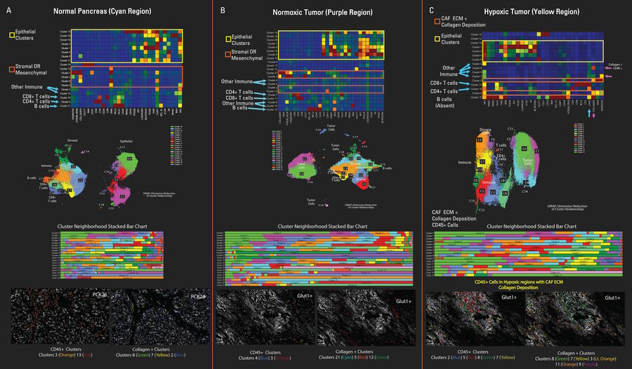 Cluster analysis and dimension reduction revealed fewer populations in the hypoxic tumor region compared to the other regions 