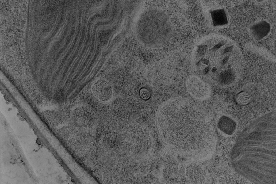 Freeze substitution of Lingulodinium polyedra (extrusomes). Courtesy Lindemann E, Fraunhofer IG B, Functional Genomics, Stuttgart; related instrument: Leica EM SPF.