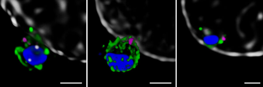 STED for malaria research