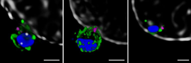 STED pour la recherche sur le paludisme : Le STED 3D à 775nm permet d’élucider les mécanismes à l’origine d’une invasion des érythrocytes par des mérozoïtes. Les images montrent des superpositions de RON4 (magenta) avec les protéines PfRh5 (à gauche, vert), PfRipr (au centre, vert), PfCyRPA (à droite, vert). Le marquage nucléaire est indiquée en bleu et la membrane des érythrocytes en gris. Barre d’échelle : 1 µm. Image fournie avec l’aimable autorisation de Jennifer Volz, Alan Cowman, Walter et Eliza Hall Institute of Medical Research, Australia, et Marko Lampe, EMBL, Allemagne.