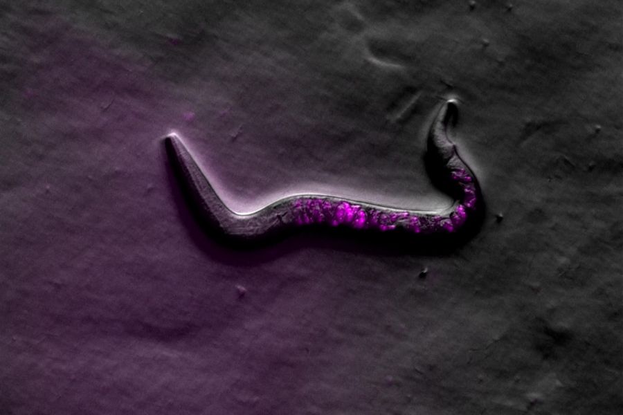 Image of C. elegans (roundworm) taken with Rottermann contrast and fluorescence (mCherry).
