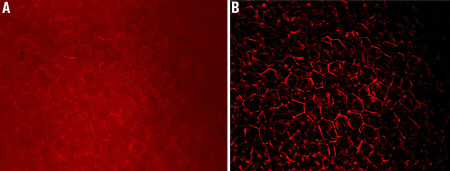 Images of adipose tissue expressing RFP taken with EDoF via a z stack of 23 images (total height of 186 µm): A) raw widefield image and B) THUNDER image (Model Organism with LVCC). Images courtesy of Dr. Rana Gupta, Touchstone Diabetes Center, University of Texas Southwestern Medical Center, Dallas, USA.