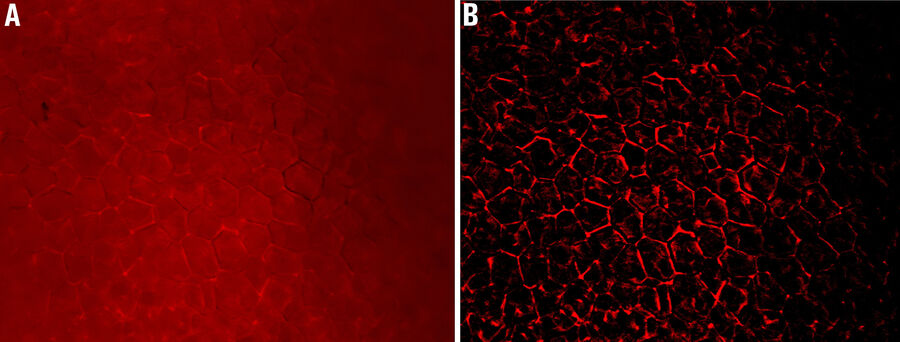 Images of adipose tissue expressing RFP Images of adipose tissue expressing RFP taken with EDoF via a z stack of 23 images (total height of 186 µm): A) raw widefield image and B) THUNDER image (taken with a THUNDER Imager Model Organism with LVCC). Images courtesy of Dr. Rana Gupta, Touchstone Diabetes Center, University of Texas Southwestern Medical Center, Dallas, USA.