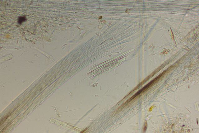 Imaged with parallel polarizers Imaged with parallel polarizers