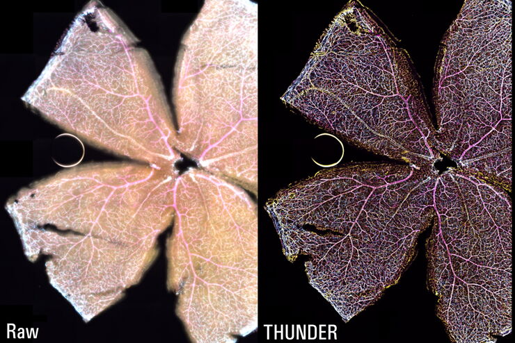 Mouse retina_widefield and LVCC
