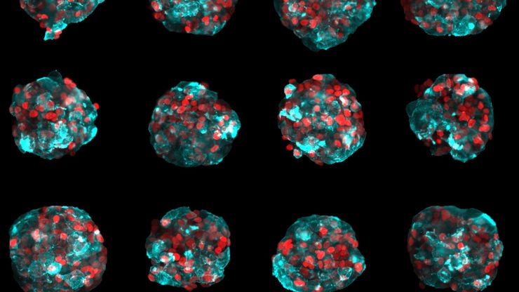 Fixed spheroids generated from T47D cell line expressing LifeAct RFP (cyan) and H2B GFP (red). 