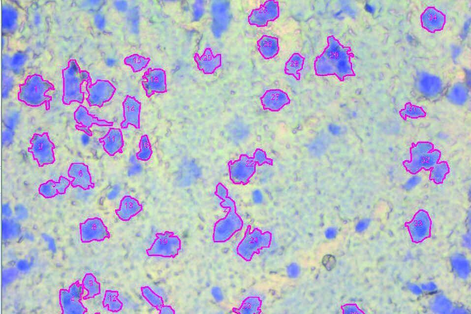 Image of a 12-μm thick brain section, which was stained with Toluidin blue, before dissection. It was taken with a microscope using a 63x objective. 12-um_thick_brain_section_stained_with_Toluidin_blue.jpg