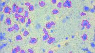 Image of a 12-μm thick brain section, which was stained with Toluidin blue, before dissection. It was taken with a microscope using a 63x objective.