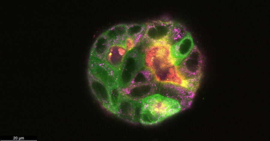 MDCK cysts (CLSM) on day 9