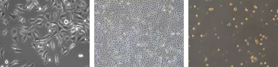 Mammalian cells can be distinguished according to their morphology. Fibroblasts (left) have a bipolar or multipolar shape. Epithelial-like cells (middle) show more regular dimensions and lymphoblast-like cells (right) are round and grow in suspension. 