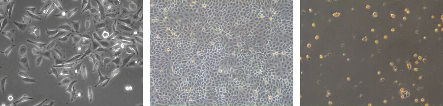 Mammalian cells can be distinguished according to their morphology. Fibroblasts (left) have a bipolar or multipolar shape. Epithelial-like cells (middle) show more regular dimensions and lymphoblast-like cells (right) are round and grow in suspension. 