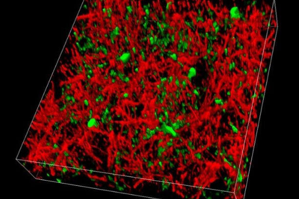 Effortless separation of GFP (green) and YFP (red) expressed in the cortex of a live mouse by capturing either two channels simultaneously or conducting a spectral emission scan and applying channel unmixing in the LAS X software.